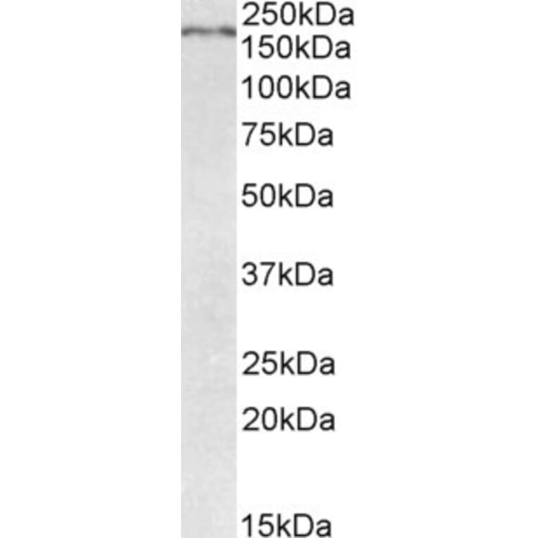 Western Blot - Anti-Robo1 Antibody (A84259) - Antibodies.com