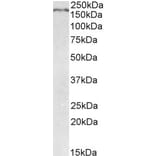 Western Blot - Anti-Robo1 Antibody (A84259) - Antibodies.com