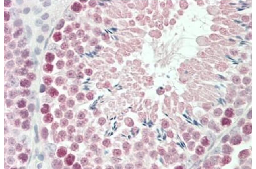 Immunohistochemistry - Anti-Robo1 Antibody (A84259) - Antibodies.com