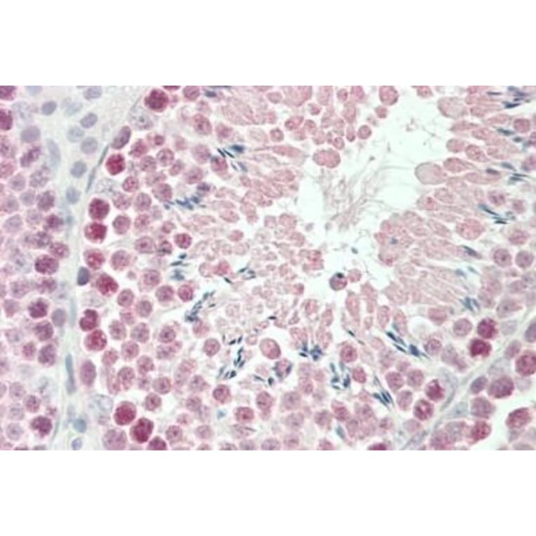Immunohistochemistry - Anti-Robo1 Antibody (A84259) - Antibodies.com