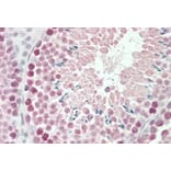 Immunohistochemistry - Anti-Robo1 Antibody (A84259) - Antibodies.com