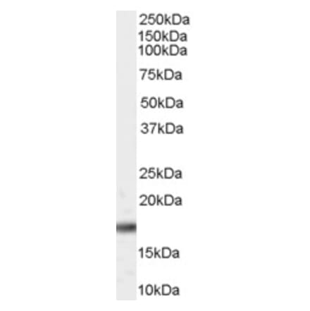 Western Blot - Anti-Pin1 Antibody (A84260) - Antibodies.com