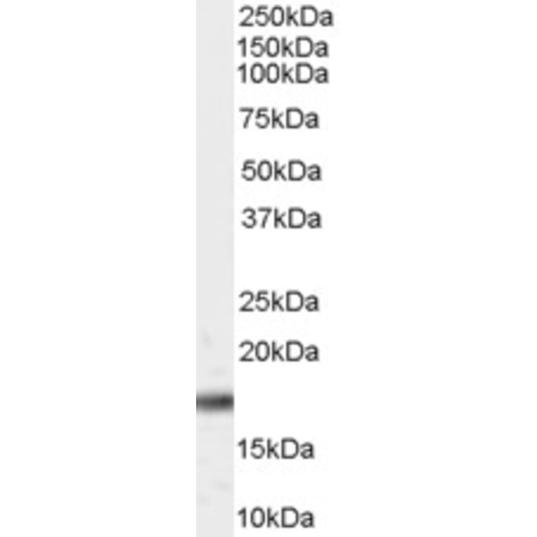 Western Blot - Anti-Pin1 Antibody (A84260) - Antibodies.com