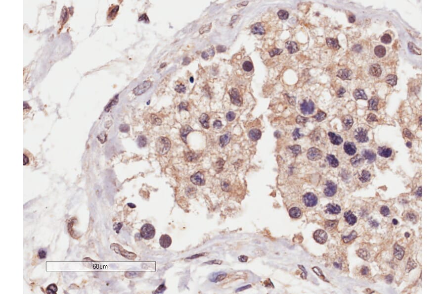 Immunohistochemistry - Anti-SLC22A16 Antibody (A84262) - Antibodies.com