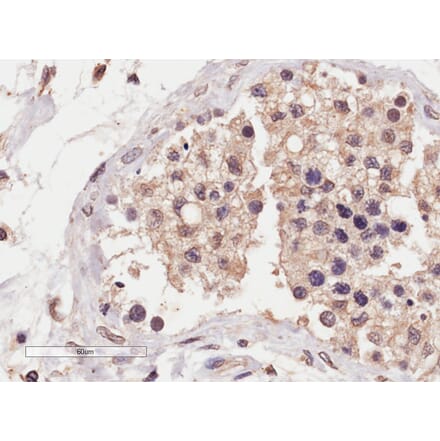 Immunohistochemistry - Anti-SLC22A16 Antibody (A84262) - Antibodies.com