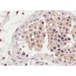Immunohistochemistry - Anti-SLC22A16 Antibody (A84262) - Antibodies.com