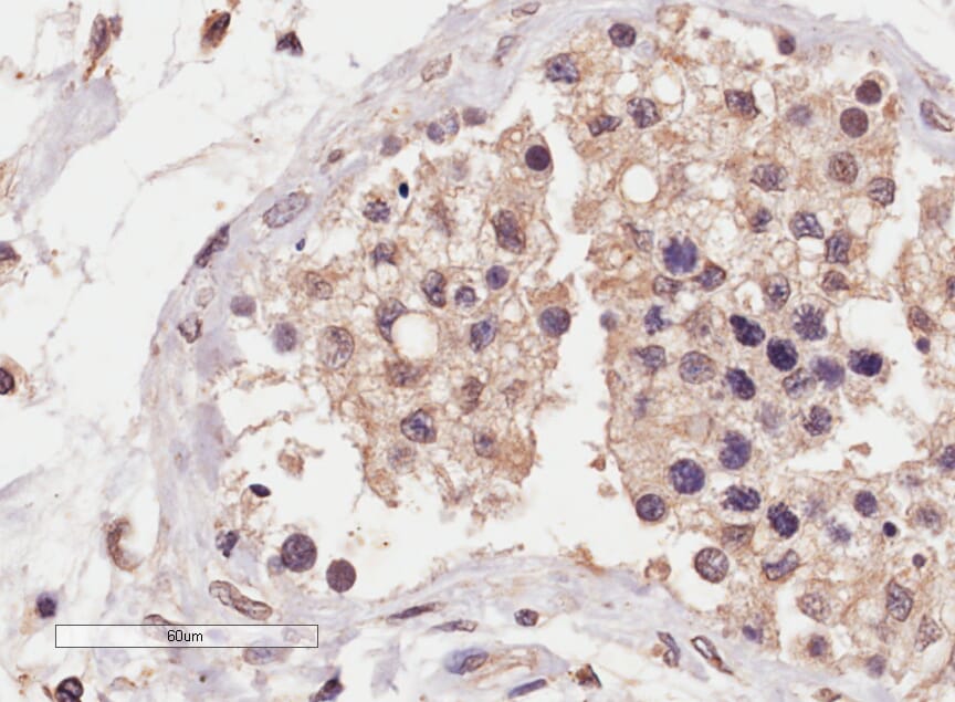 Anti-SLC22A16 Antibody (A84262) (4µg/ml) staining of paraffin embedded Human Testis. Microwaved antigen retrieval with Tris/EDTA buffer pH9, HRP-staining.