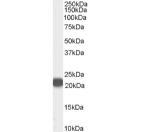 Western Blot - Anti-RKIP Antibody (A84263) - Antibodies.com