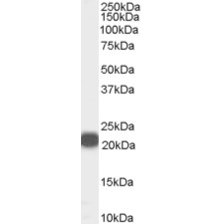 Western Blot - Anti-RKIP Antibody (A84263) - Antibodies.com