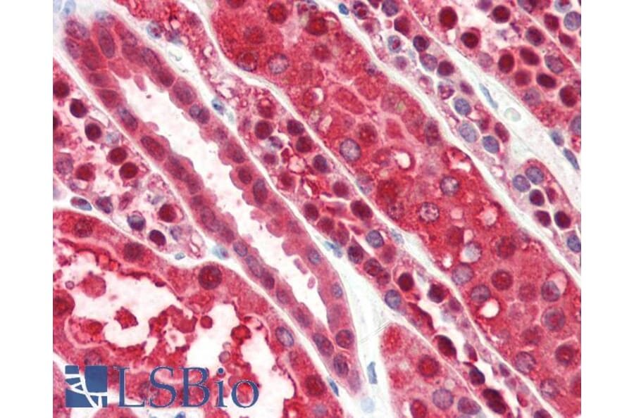 Immunohistochemistry - Anti-RKIP Antibody (A84263) - Antibodies.com