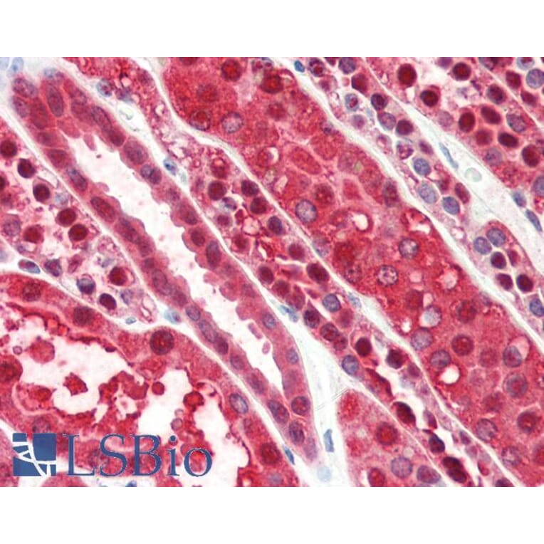Immunohistochemistry - Anti-RKIP Antibody (A84263) - Antibodies.com