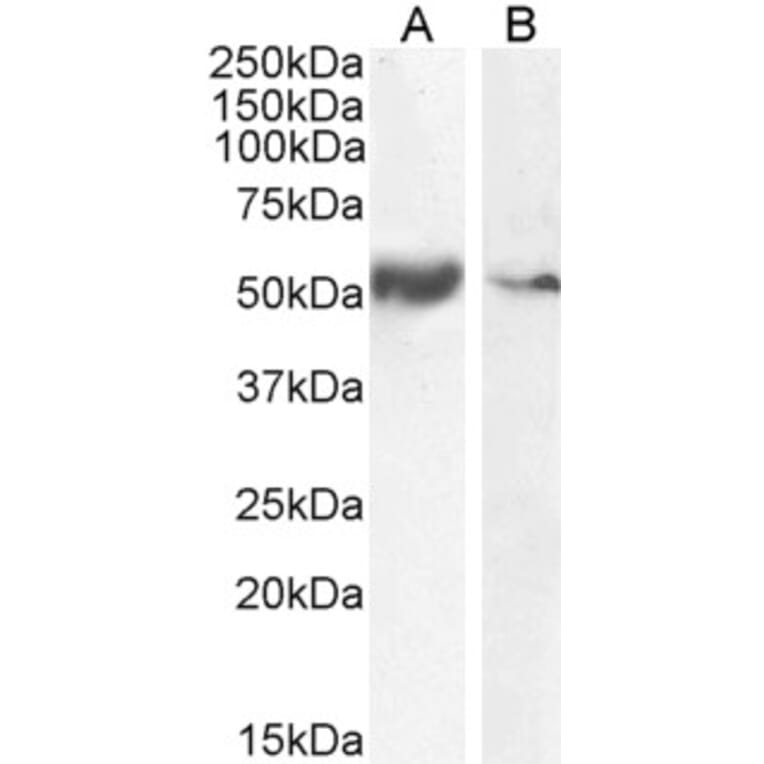 Western Blot - Anti-xCT Antibody (A84265) - Antibodies.com