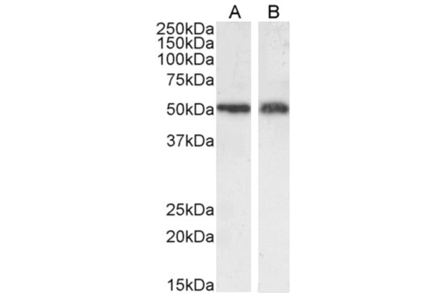 Western Blot - Anti-xCT Antibody (A84265) - Antibodies.com