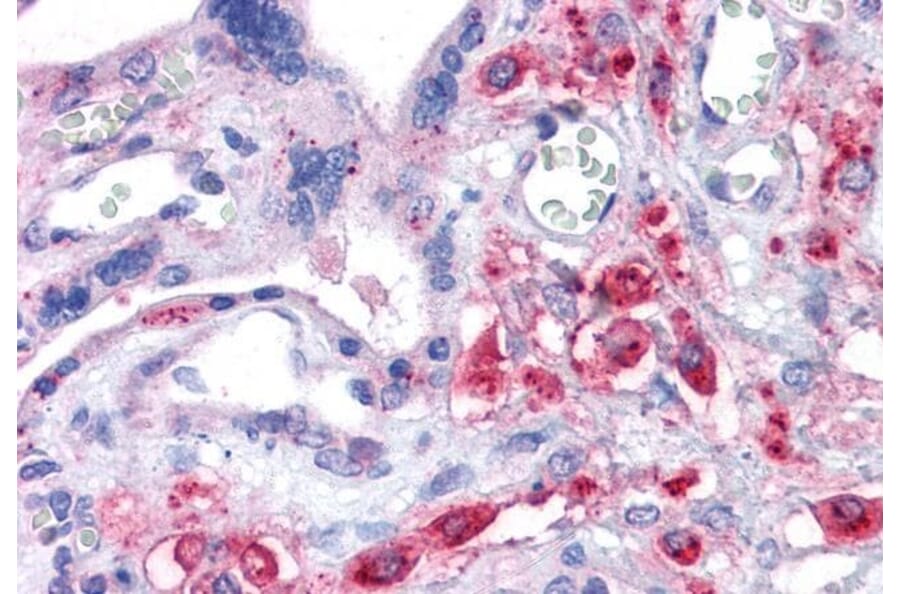 Immunohistochemistry - Anti-xCT Antibody (A84265) - Antibodies.com