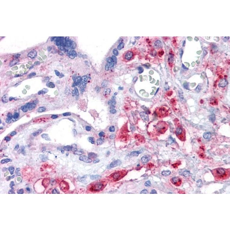 Immunohistochemistry - Anti-xCT Antibody (A84265) - Antibodies.com