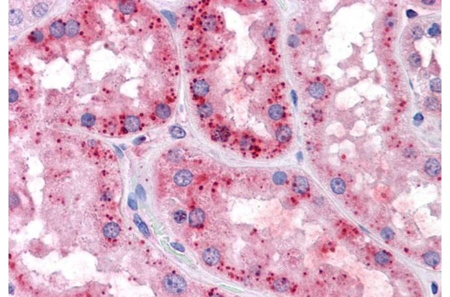 Immunohistochemistry - Anti-xCT Antibody (A84265) - Antibodies.com