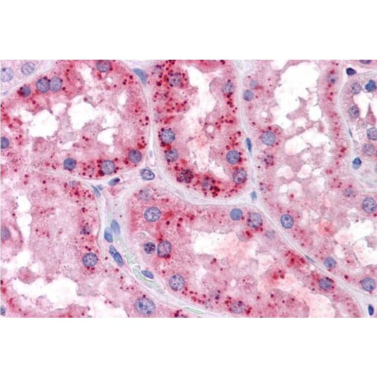 Immunohistochemistry - Anti-xCT Antibody (A84265) - Antibodies.com