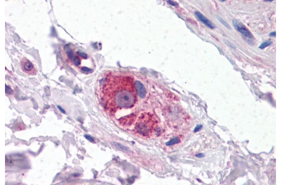 Immunohistochemistry - Anti-Cyp26B1 Antibody (A84266) - Antibodies.com