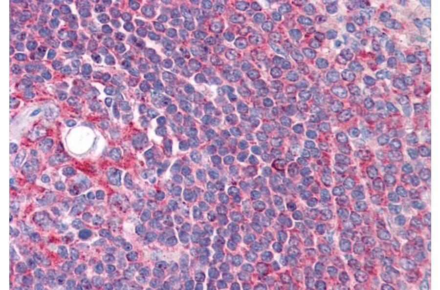 Immunohistochemistry - Anti-Cyp26B1 Antibody (A84266) - Antibodies.com