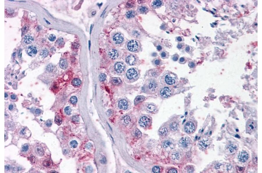 Immunohistochemistry - Anti-Cyp26B1 Antibody (A84266) - Antibodies.com