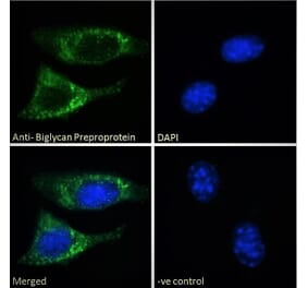 Immunofluorescence - Anti-BGN Antibody (A84269)