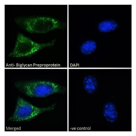 Immunofluorescence - Anti-BGN Antibody (A84269)