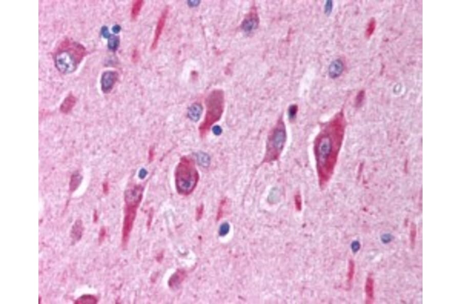 Immunohistochemistry - Anti-PI 3 Kinase Catalytic Subunit alpha/PIK3CA Antibody (A84272) - Antibodies.com