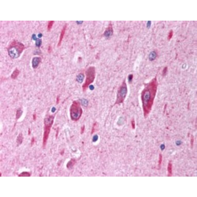 Immunohistochemistry - Anti-PI 3 Kinase Catalytic Subunit alpha/PIK3CA Antibody (A84272) - Antibodies.com