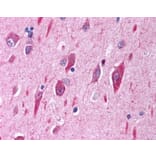 Immunohistochemistry - Anti-PI 3 Kinase Catalytic Subunit alpha/PIK3CA Antibody (A84272) - Antibodies.com