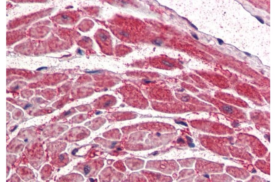Immunohistochemistry - Anti-PI 3 Kinase Catalytic Subunit alpha/PIK3CA Antibody (A84272) - Antibodies.com