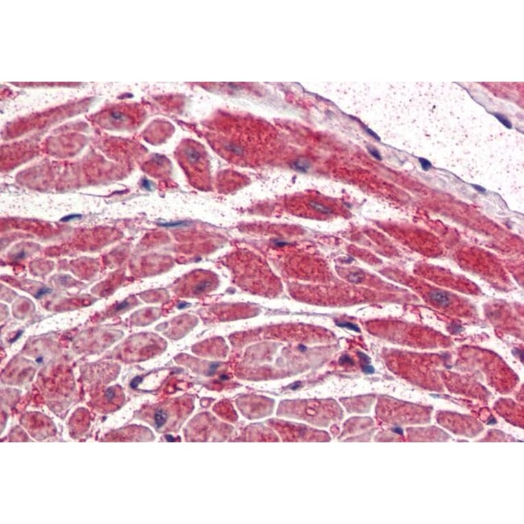 Immunohistochemistry - Anti-PI 3 Kinase Catalytic Subunit alpha/PIK3CA Antibody (A84272) - Antibodies.com