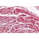 Immunohistochemistry - Anti-PI 3 Kinase Catalytic Subunit alpha/PIK3CA Antibody (A84272) - Antibodies.com