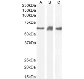 Western Blot - Anti-PRPF31 Antibody (A84273) - Antibodies.com