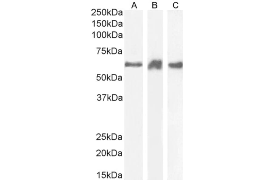Western Blot - Anti-PRPF31 Antibody (A84273) - Antibodies.com