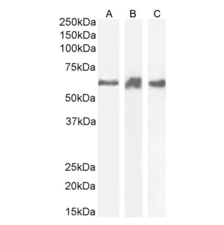 Western Blot - Anti-PRPF31 Antibody (A84273) - Antibodies.com