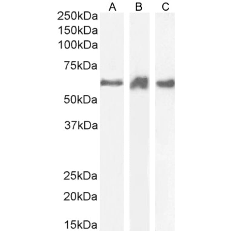 Western Blot - Anti-PRPF31 Antibody (A84273) - Antibodies.com