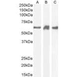 Western Blot - Anti-PRPF31 Antibody (A84273) - Antibodies.com