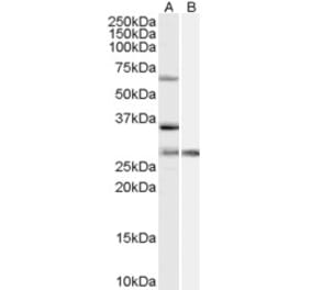 Western Blot - Anti-PRPF31 Antibody (A84273) - Antibodies.com