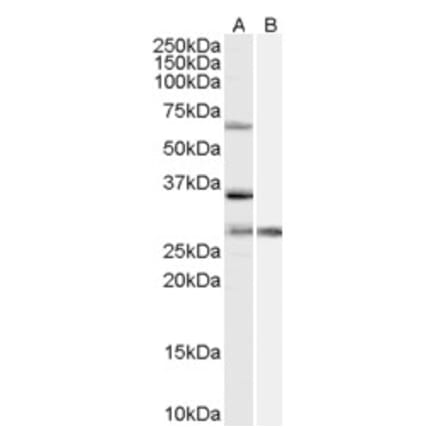 Western Blot - Anti-PRPF31 Antibody (A84273) - Antibodies.com