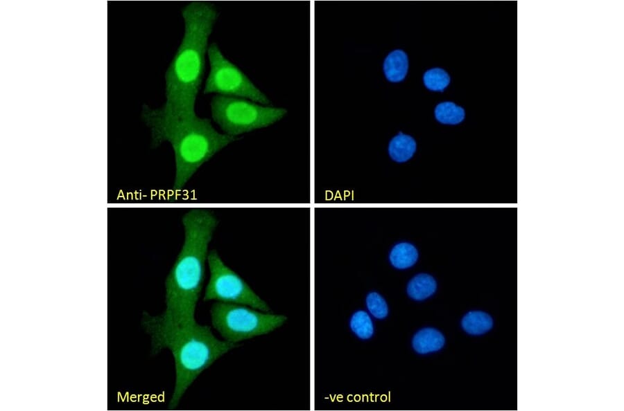 Immunofluorescence - Anti-PRPF31 Antibody (A84273) - Antibodies.com
