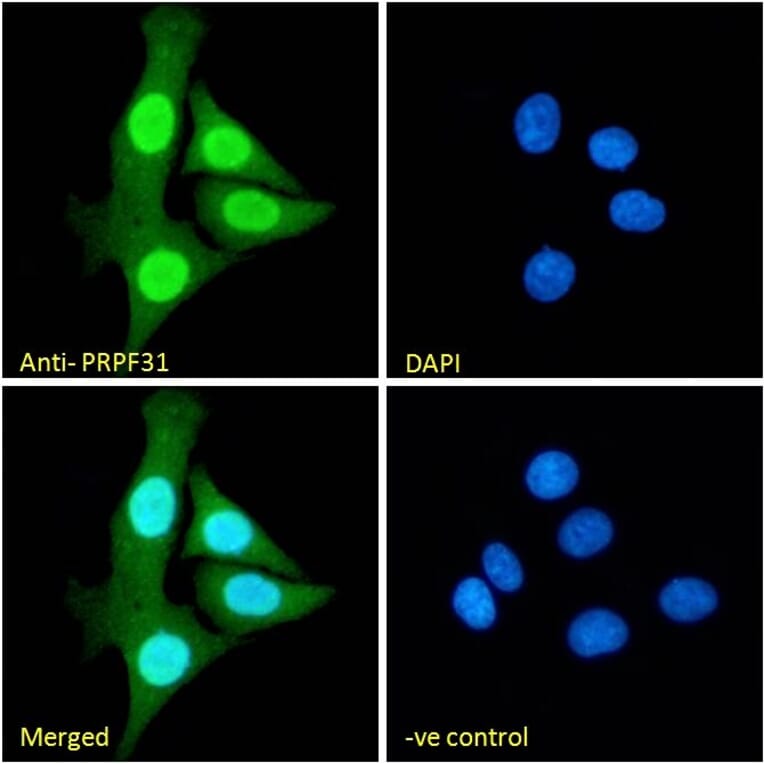 Immunofluorescence - Anti-PRPF31 Antibody (A84273) - Antibodies.com