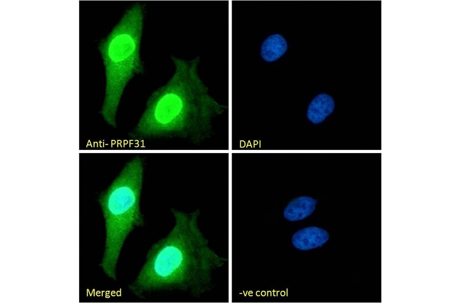 Immunofluorescence - Anti-PRPF31 Antibody (A84273) - Antibodies.com