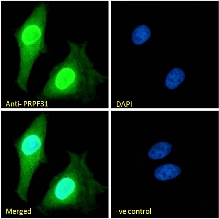 Immunofluorescence - Anti-PRPF31 Antibody (A84273) - Antibodies.com