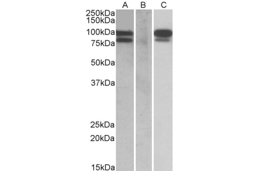 Western Blot - Anti-PCSK9 Antibody (A84274) - Antibodies.com
