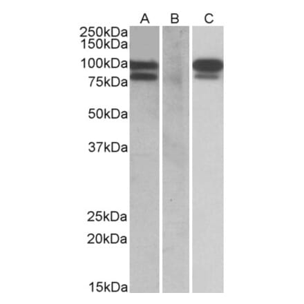 Western Blot - Anti-PCSK9 Antibody (A84274) - Antibodies.com