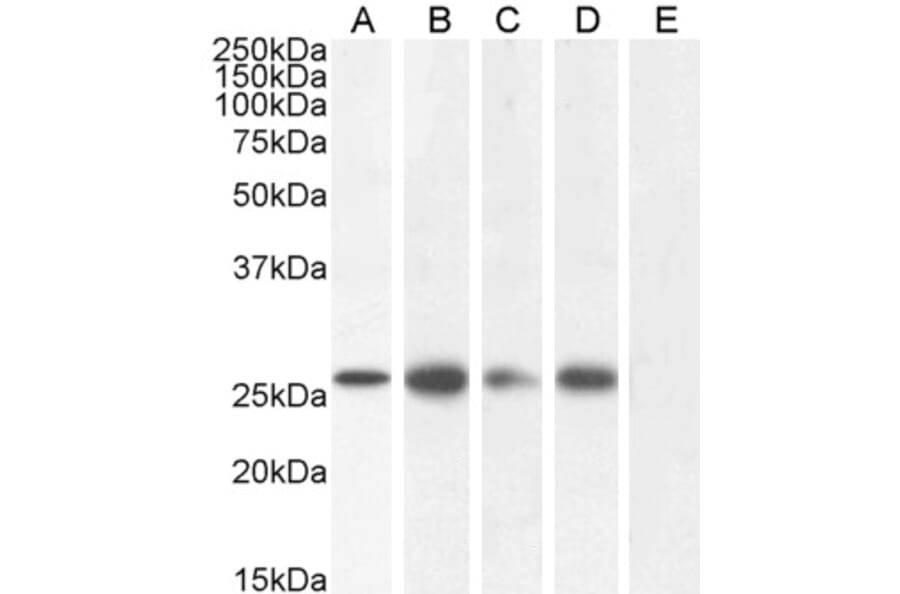 Western Blot - Anti-GJB2 Antibody (A84275) - Antibodies.com