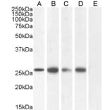 Western Blot - Anti-GJB2 Antibody (A84275) - Antibodies.com