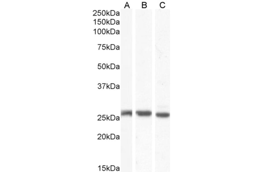 Western Blot - Anti-GJB2 Antibody (A84275) - Antibodies.com