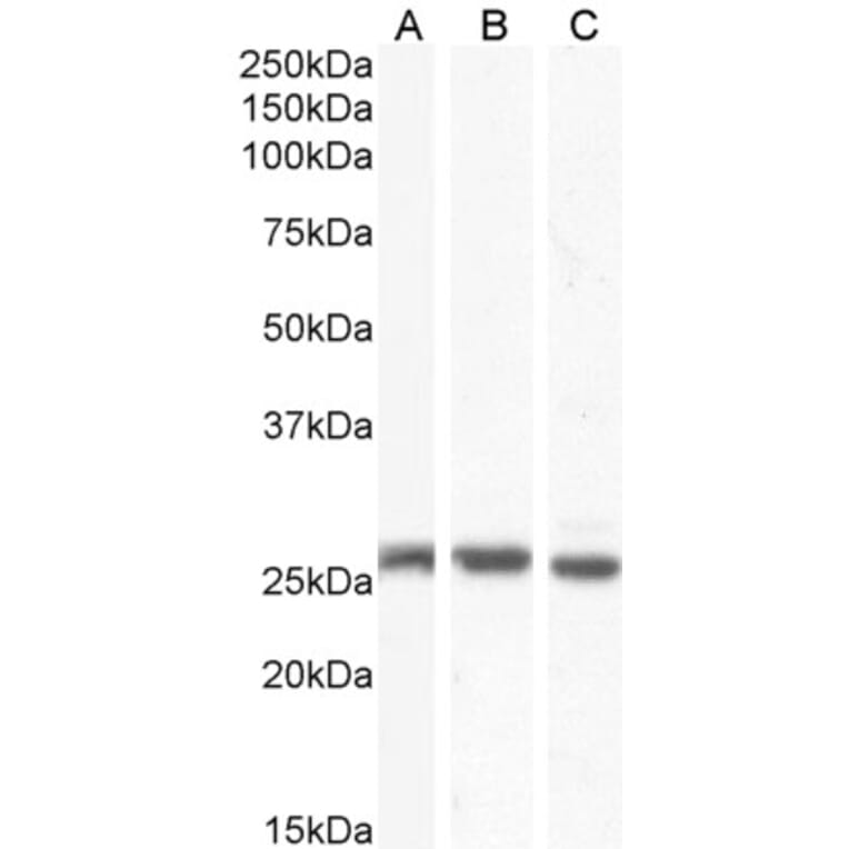 Western Blot - Anti-GJB2 Antibody (A84275) - Antibodies.com