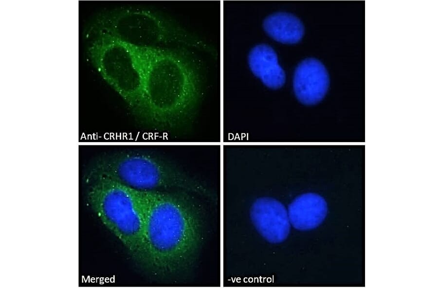 Immunofluorescence - Anti-CRF1/CRHR1 Antibody (A84278) - Antibodies.com